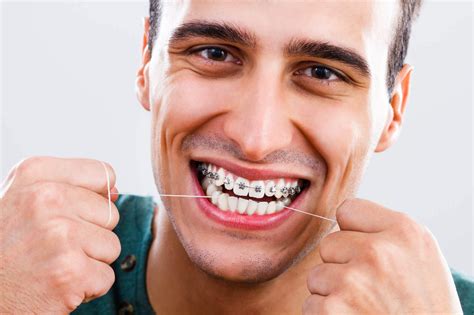 Diş Teli Tedavisi Hakkında Bilinmesi Gerekenler